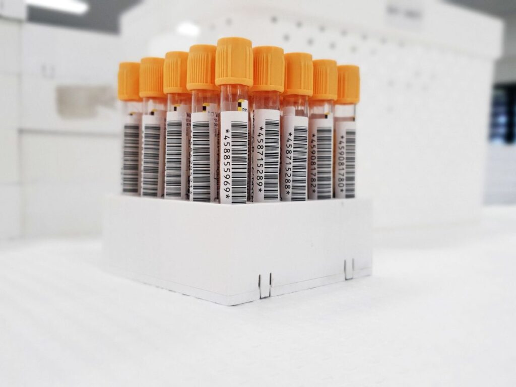 Barcoded specimen tubes in a laboratory rack