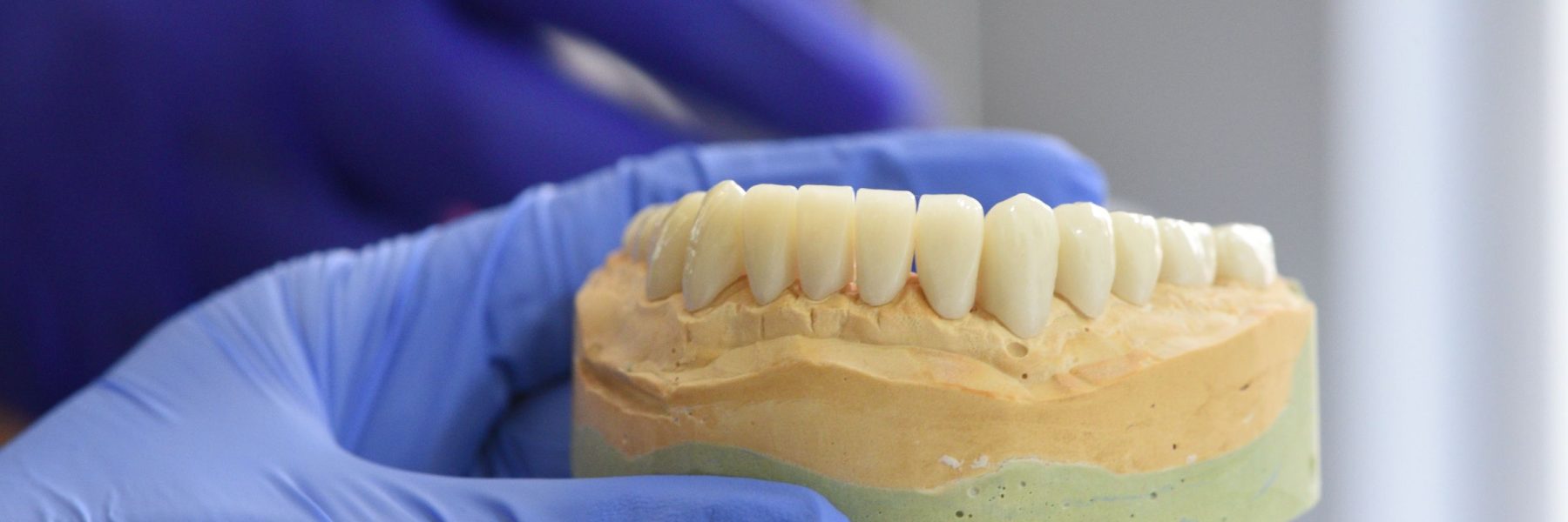Gloved hands holding a dental laboratory model