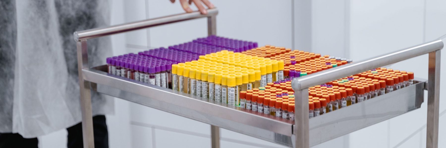 Labelled specimen vials on a transport cart